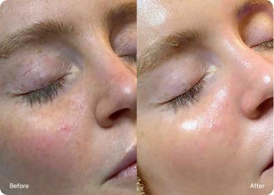 Brighter, Hydrated skin
