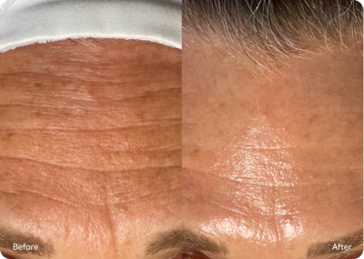 Signs of aging improved