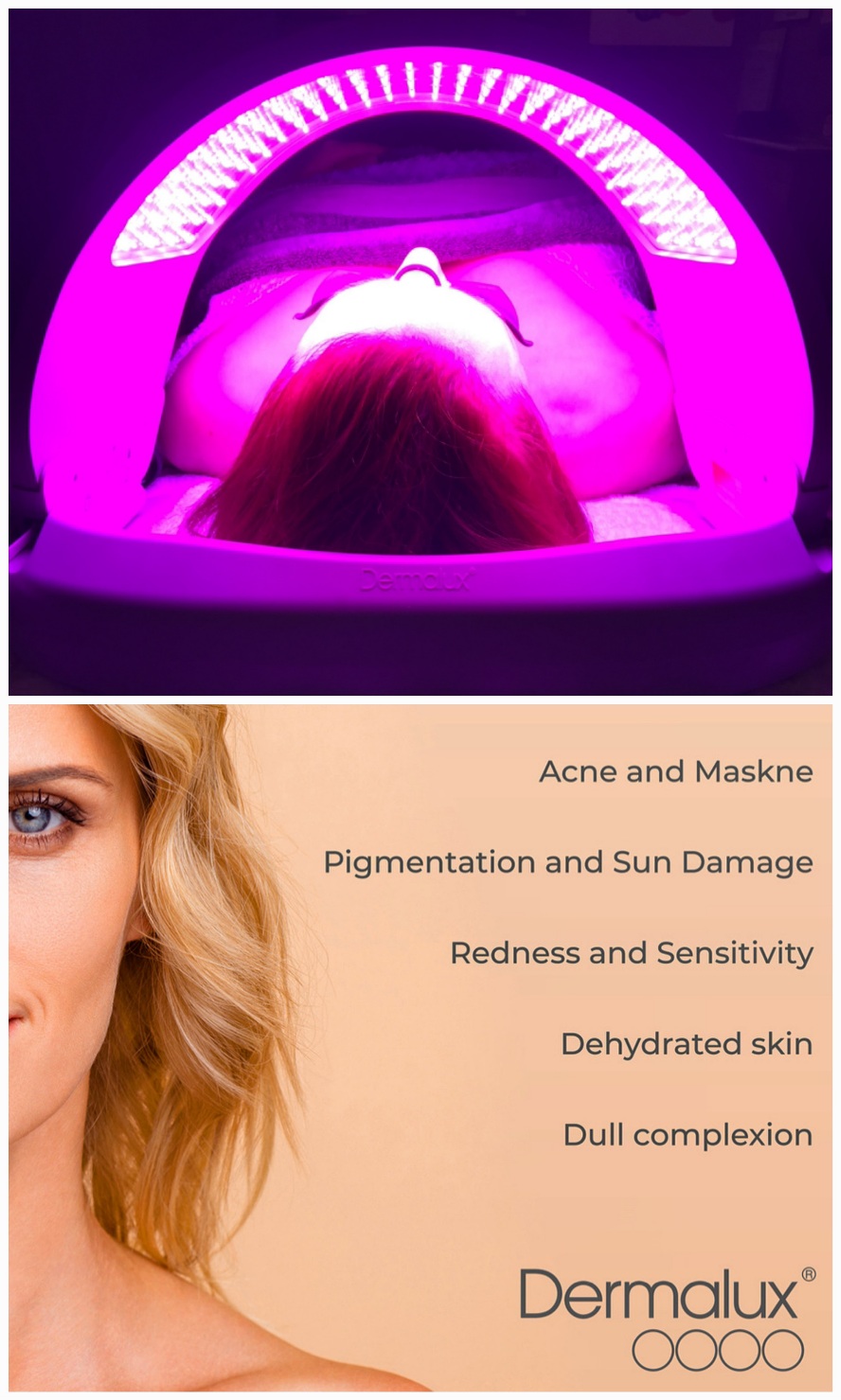 Dermalux Benefits